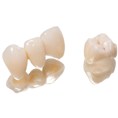 Couronne-céramique-sur-zirconium