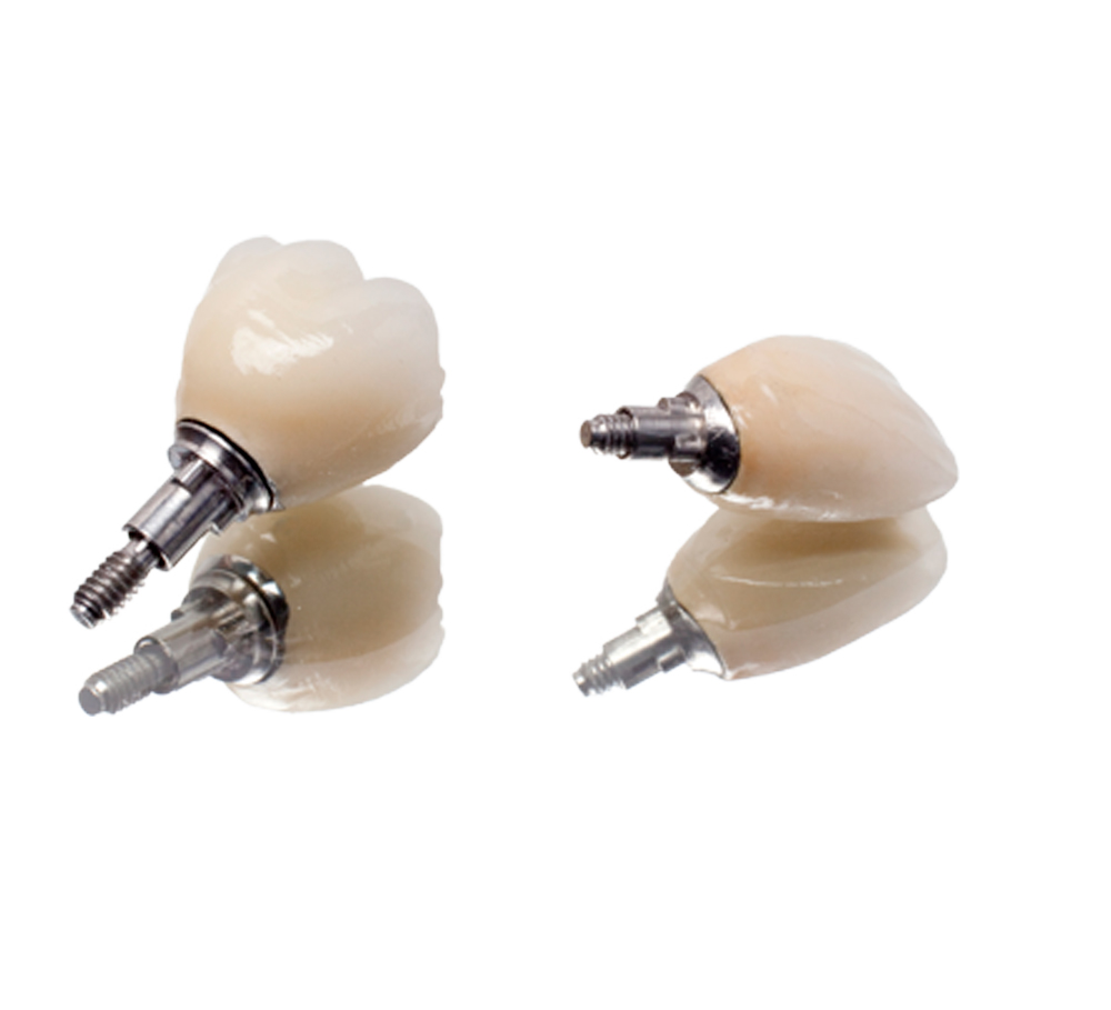 Couronne sur implant HR