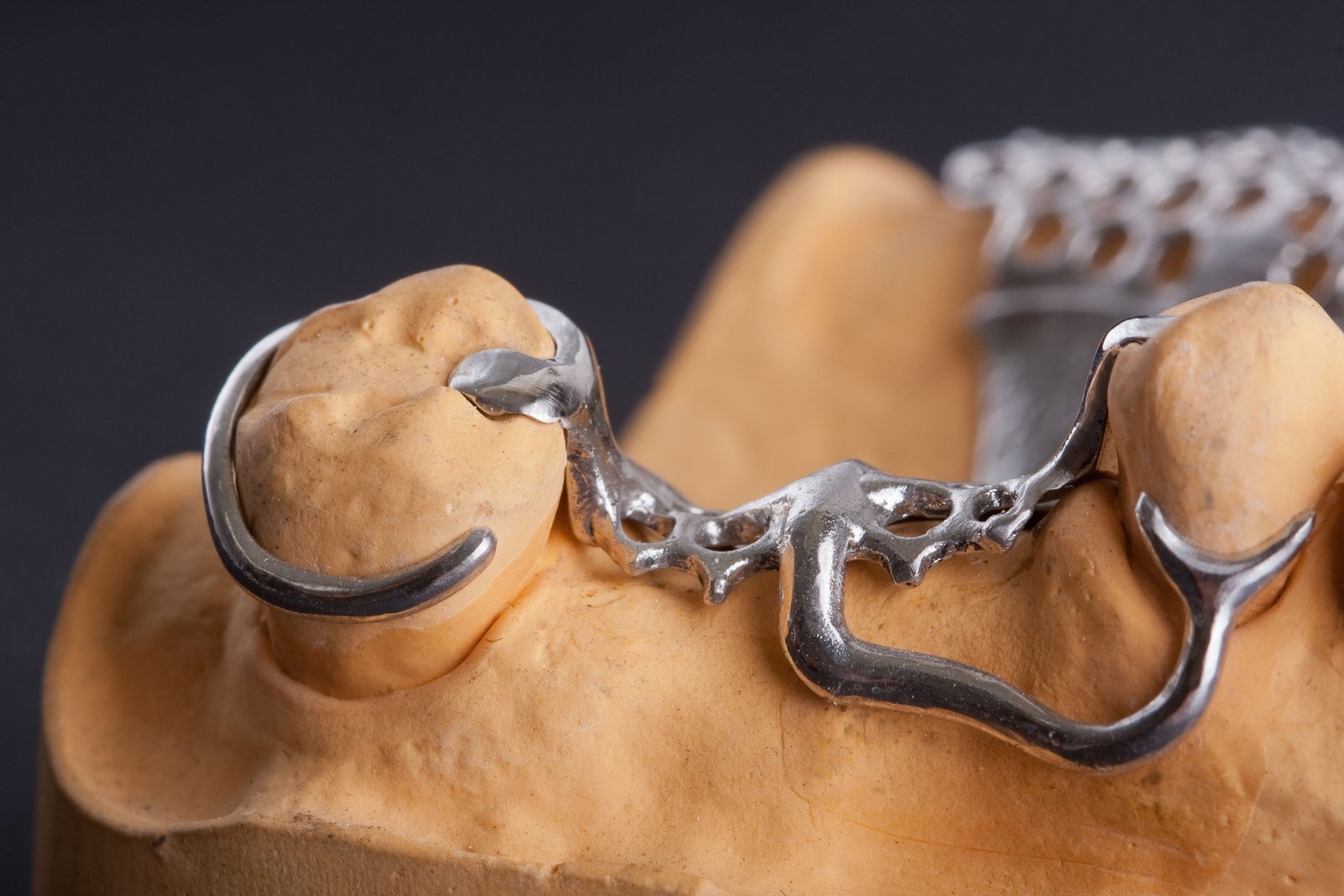 Metalen frameprothese op gipsmodel